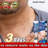 Image result for Wart Removal Cream for Face