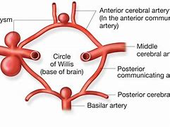 Image result for Circle of Willis