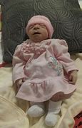 Image result for Anencephaly Angel Babies