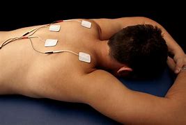 Image result for Transcutaneous Electrical Nerve Stimulation