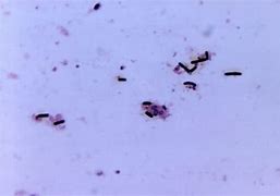 Image result for Clostridium Difficile Gram Stain