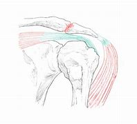 Image result for Artrose Acromioclavicular Exercicios