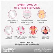 Image result for Uterine Fibroids and Back Pain