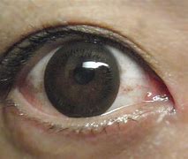 Image result for Colored Eye Lenses
