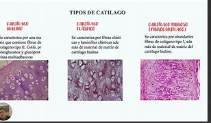 Image result for cartilaginozo