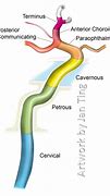 Image result for Internal Carotid Artery Branches