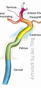 Image result for Carotid Arteries