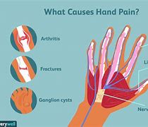 Image result for Hand Pain Types