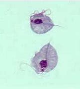 Image result for Trichomonas Vaginalis Trophozoite Microscope
