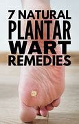 Image result for Foot Wart Treatment