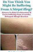 Image result for Gain Laundry Detergent Rash