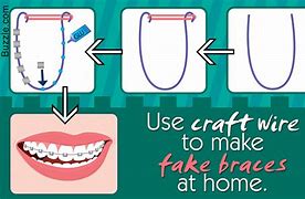 Image result for How to Make Fake Braces That Look Real
