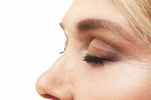 Image result for Nose Wrinkles