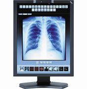 Image result for Medical Monitor