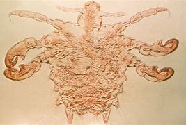 Image result for Early Stages STD Crabs