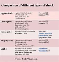 Image result for 4 Types of Shock