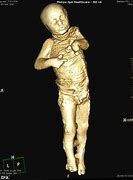 Image result for Pompeii Preserved People