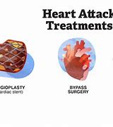 Image result for Cancer Patients Heart Attack Treatment