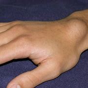 Image result for Wrist Bone Thingy