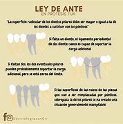 Image result for acompz�ante