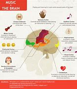 Image result for Classical Music and the Brain