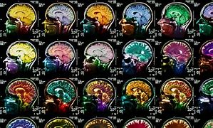 Image result for Brain Dreaming