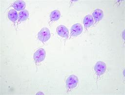 Image result for Giardia Vaginalis