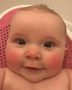 Image result for Baby Face Redish