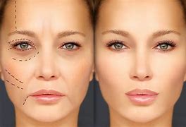 Image result for Facial Plastic Surgery