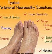 Image result for Types of Neuropathy