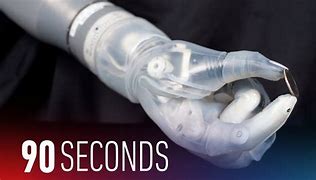 Image result for Future Prosthetic Arm