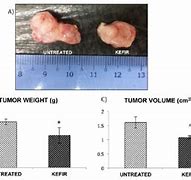 Image result for How Big Is 6Mm Tumor