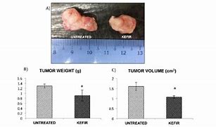 Image result for 10 Cm Tumor