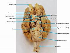 Image result for Whole Brain Diagram