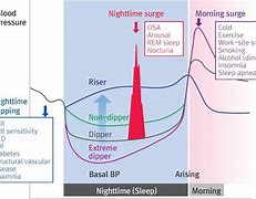 Image result for REM Sleep Blood Pressure