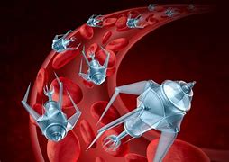 Image result for Surgical Robots