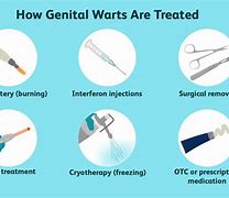 Image result for Warts On Cervix