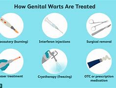 Image result for Genitals Wart Pictures Early Stage