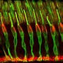 Image result for Retina Cones