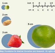 Image result for Tumor Size Chart in mm
