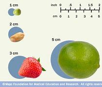 Image result for 8Mm Size Tumor