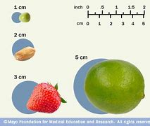 Image result for What Does a 3 Cm Mass Look Like