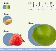 Image result for How Big Is 5 Cm Tomour