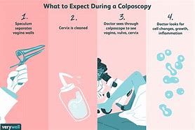 Image result for Colpolscopy Band Albums