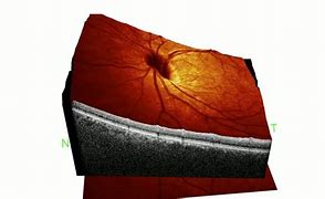 Image result for Retinal Scan