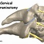 Image result for Cervical Foramen