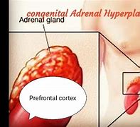 Image result for axrenal