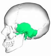 Image result for Temporal Bone