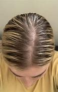Image result for Hairstyles to Hide Thinning