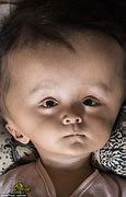 Image result for Biggest Baby Head